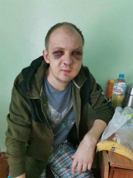 Избитому ОМОНом гродненскому таксисту грозит до 6 лет. Комментарий УВД