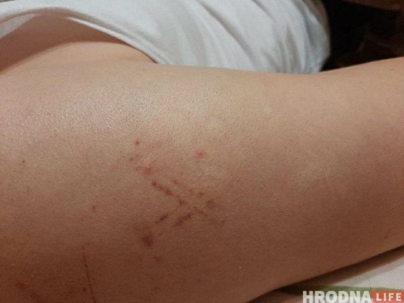 Гродненец попал в аварию с участием автозака. Ему грозит лишение "прав"
