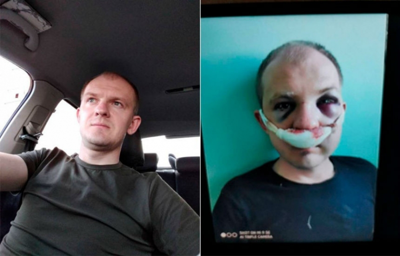 Избитому ОМОНом гродненскому таксисту грозит до 6 лет. Комментарий УВД
